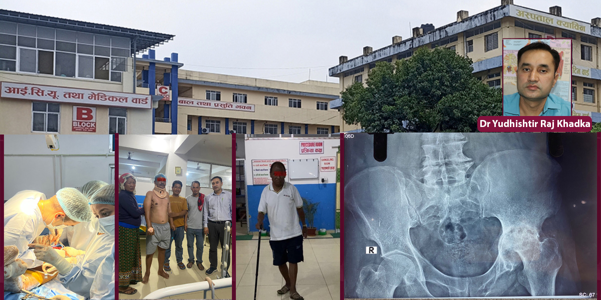 Lumbini Provincial Hospital conducts first hip transplant surgery