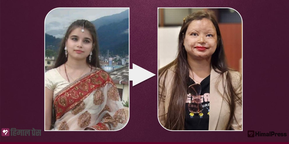 Acid attack survivor Bindabasini crafting law to combat attacks