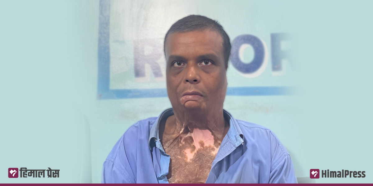 Bomb did explode at Alam’s house that day: Victim